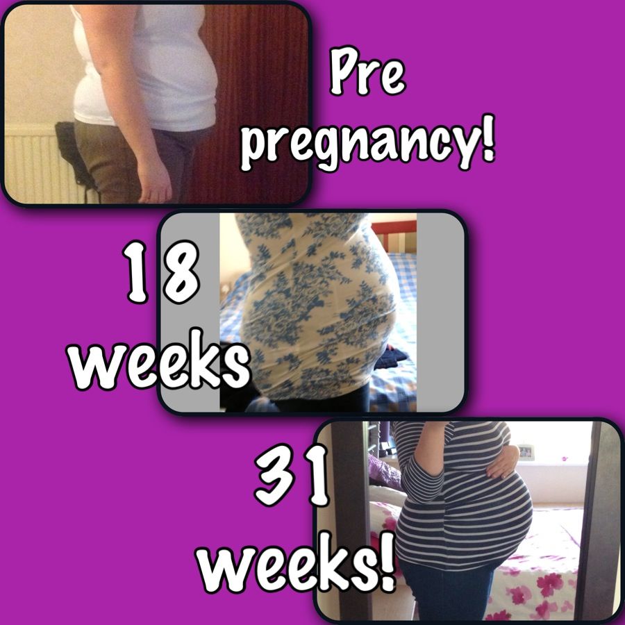 When Did You Get A Proper Bump Instead Of B Shape? - Pregnant, Plus ...